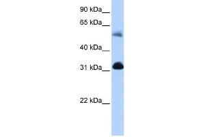Image no. 1 for anti-3-Oxoacid CoA Transferase 1 (OXCT1) (N-Term) antibody (ABIN633892)