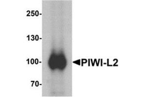 Image no. 1 for anti-Piwi-Like 2 (PIWIL2) (Middle Region) antibody (ABIN1450077)