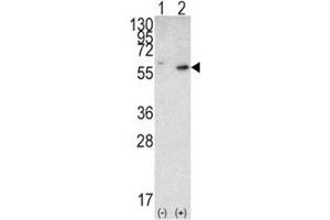 Image no. 5 for anti-Phosphatase and Tensin Homolog (PTEN) (AA 69-104) antibody (ABIN3032214)