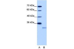 Image no. 3 for anti-Eukaryotic Translation Initiation Factor 4E Family Member 2 (EIF4E2) (N-Term) antibody (ABIN2778915)