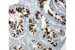 Image no. 3 for anti-Retinoblastoma-Like 1 (p107) (RBL1) (AA 1048-1068), (C-Term) antibody (ABIN3044108)
