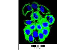 Image no. 1 for anti-Galactosamine (N-Acetyl)-6-Sulfate Sulfatase (GALNS) (AA 236-263) antibody (ABIN655593)