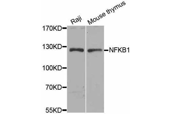 anti-Nuclear Factor of kappa Light Polypeptide Gene Enhancer in B-Cells 1 (NFKB1) antibody