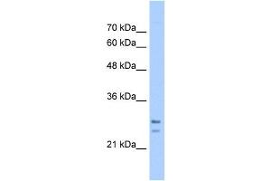 Image no. 1 for anti-Signal Recognition Particle Receptor, B Subunit (SRPRB) (C-Term) antibody (ABIN630341)