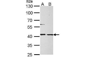 Image no. 1 for anti-Mannose Phosphate Isomerase (MPI) (Center) antibody (ABIN2855680)