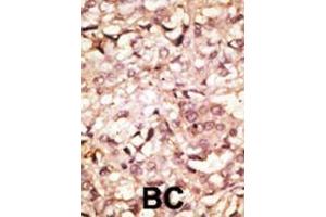 Image no. 3 for anti-Angiotensin I Converting Enzyme 2 (ACE2) (AA 773-805), (C-Term) antibody (ABIN390049)