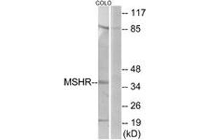 Image no. 1 for anti-Melanocortin 1 Receptor (MC1R) (AA 268-317) antibody (ABIN1535779)