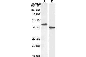 Image no. 1 for anti-Paired Box 5 (PAX5) (N-Term) antibody (ABIN184804)