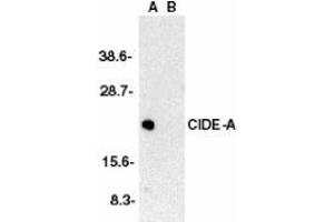 Image no. 2 for anti-Cell Death-Inducing DFFA-Like Effector A (CIDEA) (C-Term) antibody (ABIN499625)