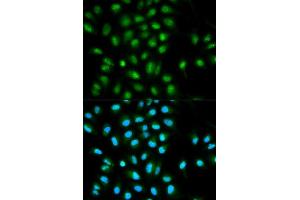 Image no. 2 for anti-PYD and CARD Domain Containing (PYCARD) antibody (ABIN3021617)