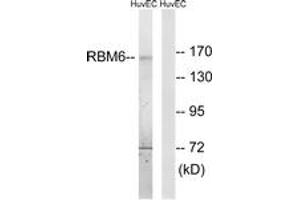 Image no. 1 for anti-RNA Binding Motif Protein 6 (RBM6) (AA 991-1040) antibody (ABIN1533802)