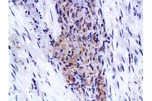 Image no. 1 for anti-Cell Adhesion Molecule 1 (CADM1) (AA 365-442) antibody (ABIN738351)