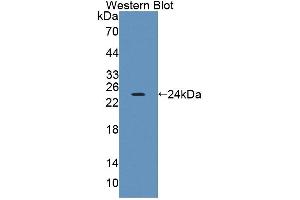 Image no. 1 for anti-Protein tyrosine Phosphatase, Receptor Type, A (PTPRA) (AA 624-800) antibody (ABIN5014196)