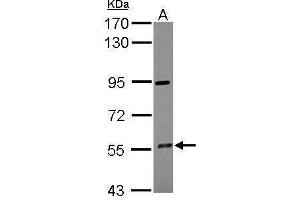 Image no. 1 for anti-Cytochrome P450, Family 4, Subfamily F, Polypeptide 12 (CYP4F12) (Center) antibody (ABIN2856001)