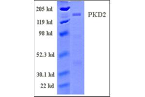 Image no. 1 for Polycystic Kidney Disease 2 (Autosomal Dominant) (PKD2) (Active) protein (ABIN411918)
