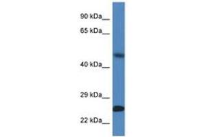 Image no. 1 for anti-Sorting Nexin 10 (SNX10) (AA 100-149) antibody (ABIN6747387)