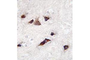 Image no. 3 for anti-Kv Channel Interacting Protein 3, Calsenilin (KCNIP3) (AA 1-30), (N-Term) antibody (ABIN357125)