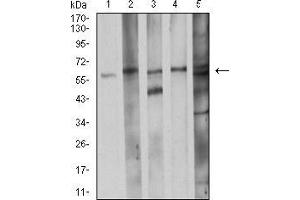 Image no. 2 for anti-Cell Division Cycle 37 Homolog (S. Cerevisiae) (CDC37) (AA 241-378) antibody (ABIN5542606)
