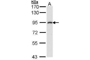 Image no. 5 for anti-Inhibitor of kappa Light Polypeptide Gene Enhancer in B-Cells, Kinase beta (IKBKB) (C-Term) antibody (ABIN2856162)