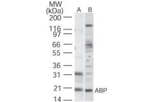 Image no. 1 for anti-Kv Channel Interacting Protein 1 (KCNIP1) (AA 11-28) antibody (ABIN208269)