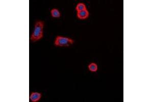 Image no. 1 for anti-Melanocortin 5 Receptor (MC5R) (C-Term) antibody (ABIN2957661)