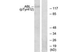 Image no. 1 for anti-C-Abl Oncogene 1, Non-Receptor tyrosine Kinase (ABL1) (AA 406-455), (pTyr393) antibody (ABIN1531765)