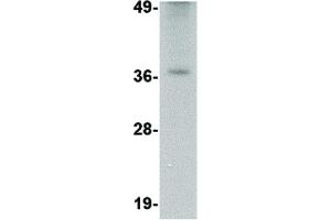 Image no. 2 for anti-three Prime Repair Exonuclease 2 (Trex2) (C-Term) antibody (ABIN6657188)