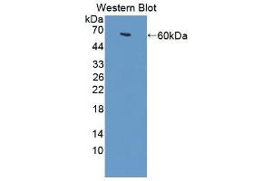 Image no. 1 for anti-tau Tubulin Kinase 2 (TTBK2) (AA 21-314) antibody (ABIN1872004)
