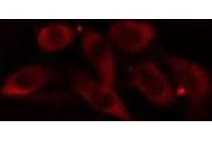 Image no. 1 for anti-Cytochrome P450, Family 3, Subfamily A, Polypeptide 4 (CYP3A4) antibody (ABIN6261171)