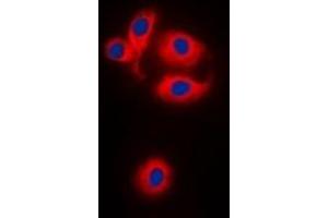 Image no. 1 for anti-Mitochondrial Ribosomal Protein S22 (MRPS22) antibody (ABIN2801277)