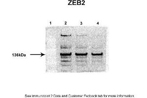 Image no. 2 for anti-Zinc Finger E-Box Binding Homeobox 2 (ZEB2) (Middle Region) antibody (ABIN2780948)