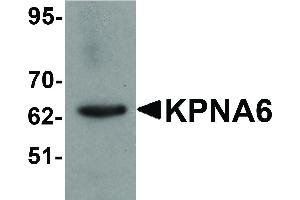 Image no. 1 for anti-Karyopherin alpha 6 (Importin alpha 7) (KPNA6) (N-Term) antibody (ABIN6657020)