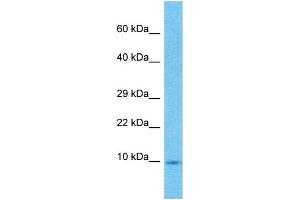 Image no. 1 for anti-High Mobility Group Nucleosomal Binding Domain 3 (HMGN3) (Middle Region) antibody (ABIN2784552)
