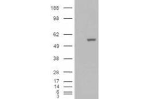 Image no. 3 for anti-Aldehyde Dehydrogenase 1 Family, Member A1 (ALDH1A1) (C-Term) antibody (ABIN184581)