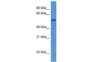 Image no. 2 for anti-Histidyl-tRNA Synthetase (HARS1) (N-Term) antibody (ABIN2788770)