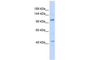 Image no. 1 for anti-TAF4 RNA Polymerase II, TATA Box Binding Protein (TBP)-Associated Factor, 135kDa (TAF4) (AA 935-984) antibody (ABIN6742373)