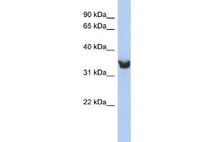 Image no. 1 for anti-delta-Like 1 Homolog (Drosophila) (DLK1) (Middle Region) antibody (ABIN2773880)