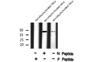 Image no. 4 for anti-Transforming Growth Factor beta 1 Induced Transcript 1 (TGFB1I1) (pTyr60) antibody (ABIN6271294)