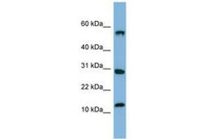 Image no. 1 for anti-Signal Recognition Particle 19kDa (SRP19) (C-Term) antibody (ABIN6741676)