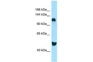 Image no. 1 for anti-Diacylglycerol Kinase, delta 130kDa (DGKD) (C-Term) antibody (ABIN2790326)
