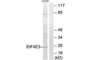 Image no. 1 for anti-Eukaryotic Translation Initiation Factor 4E Family Member 3 (EIF4E3) (AA 141-190) antibody (ABIN1534901)