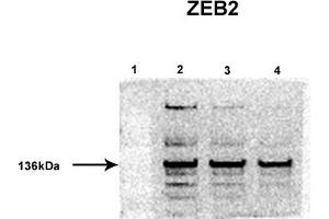 Image no. 4 for anti-Zinc Finger E-Box Binding Homeobox 2 (ZEB2) (Middle Region) antibody (ABIN2780948)