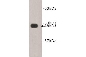 Image no. 1 for anti-FAT Tumor Suppressor Homolog 4 (FAT4) antibody (ABIN1854894)