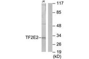 Image no. 1 for anti-General Transcription Factor IIE, Polypeptide 2 (GTF2E2) (AA 151-200) antibody (ABIN1533686)