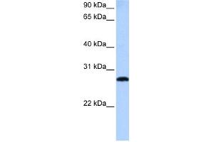Image no. 1 for anti-MAX-Like Protein X (MLX) (Middle Region) antibody (ABIN2784559)