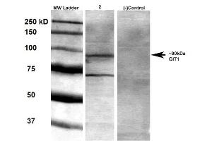 Western Blot analysis of Rat brain membrane lysate showing detection of GIT1 protein using Mouse Anti-GIT1 Monoclonal Antibody, Clone S39B-8 .