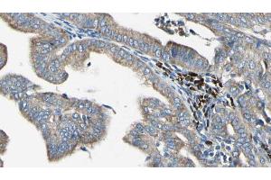 Image no. 1 for anti-Mitochondrial Ribosomal Protein L41 (MRPL41) antibody (ABIN6264202)