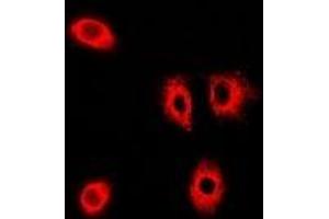 Image no. 1 for anti-Golgi-Associated PDZ and Coiled-Coil Motif Containing (GOPC) antibody (ABIN2966912)