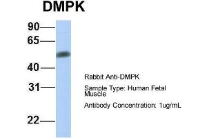Image no. 2 for anti-Dystrophia Myotonica-Protein Kinase (DMPK) (Middle Region) antibody (ABIN2775281)