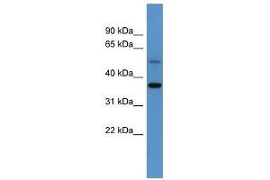 Image no. 1 for anti-Glycogenin (GYG) (C-Term) antibody (ABIN928252)